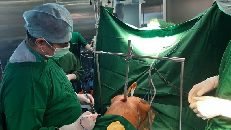 subxiphoid VATS planned by Dr Avinash Dal