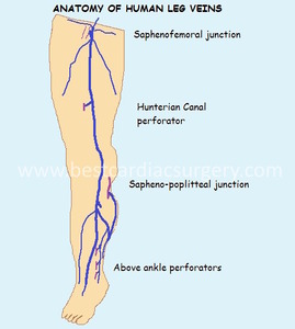 Varicose Veins Surgery- Anatomy of Human Leg Veins by Dr Avinash Dal