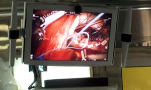 Robotic Cardiac Surgery- Procedure by Dr Avinash Dal